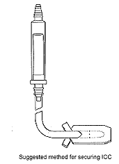 Suggested method for securing ICC